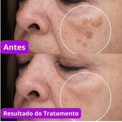 Sérum Facial Rosa Mosqueta Dermachem 30ml Original | Clareador de Manchas, Hidratação Profunda e Antissinais