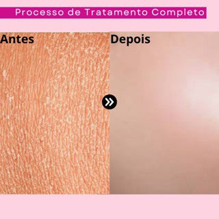 Sérum Facial Rosa Mosqueta Dermachem 30ml Original | Clareador de Manchas, Hidratação Profunda e Antissinais