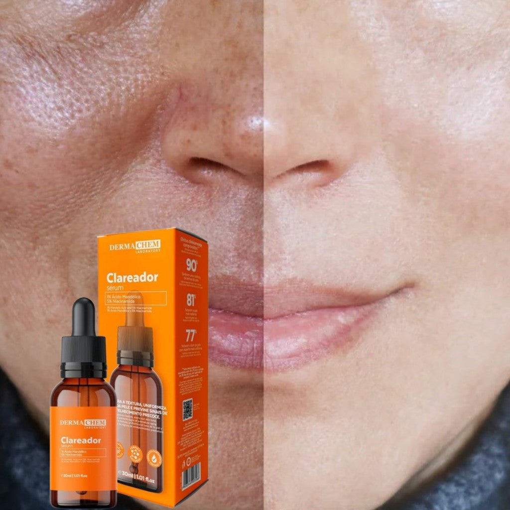 Sérum Clareador Facial Dermachem 30ml | Clareia Manchas, Melasma e Uniformiza o Tom da Pele